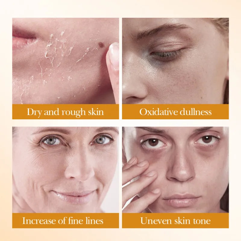 Rice Radiance 5-Piece Skincare Set