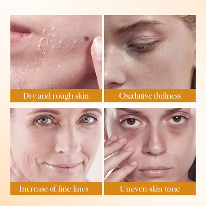 Rice Radiance 5-Piece Skincare Set