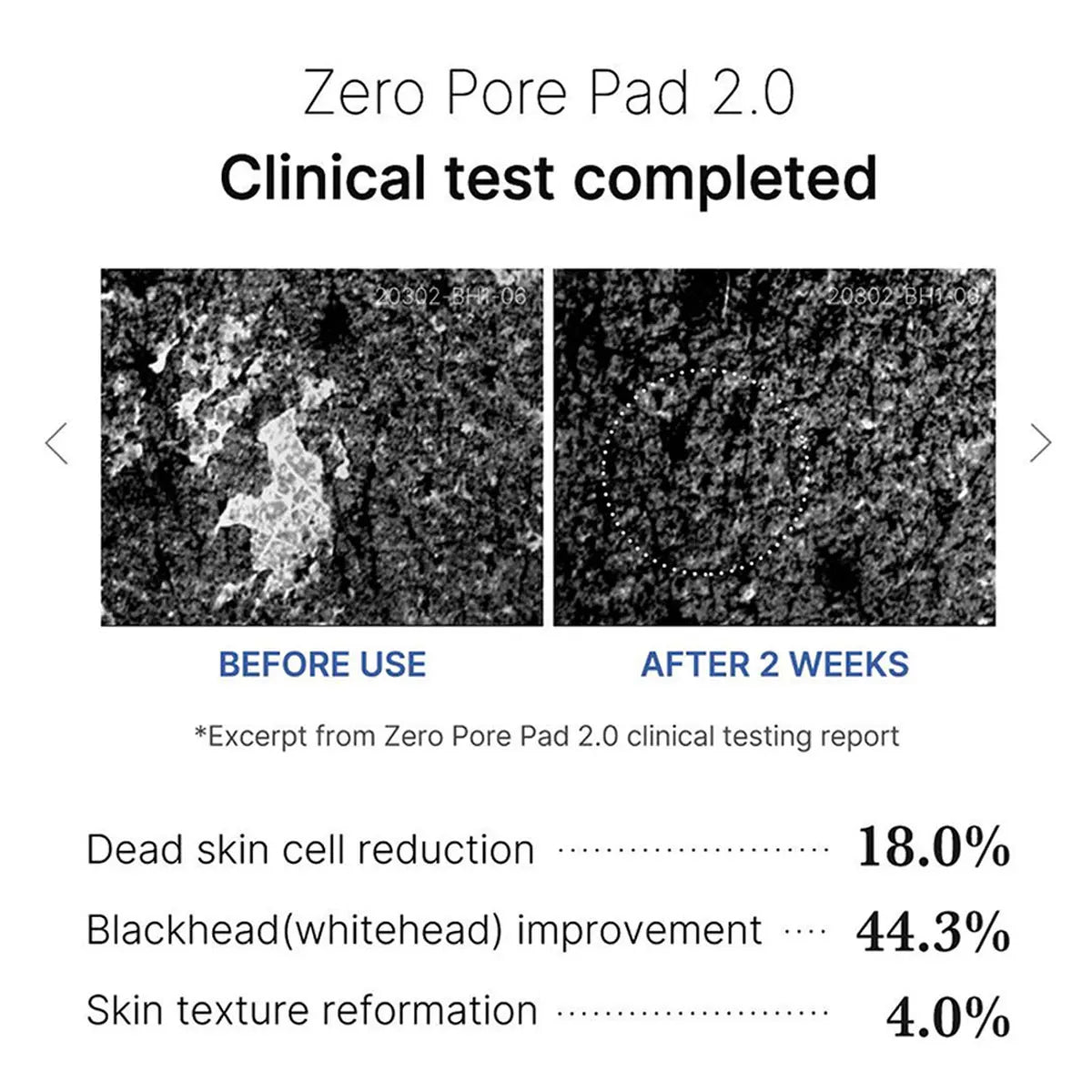 ZERO PORE PAD 2.0,Pre-Soaked Dual-Texture Cotton,Moisturizing & Calming Formula,Korean Skincare,K-Beauty,Korean Makeup